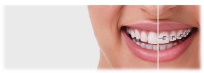 Prix d'une chirurgie dentaire sur une dent dévitalisée incluant le traitement et le suivi postopératoire au Roucas Blanc,  Marseille 7e