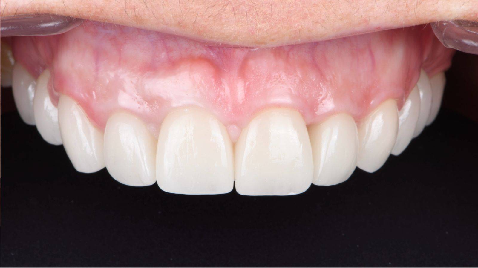 Cabinet d'orthodontie pour adultes et enfants vers Cassis et La Ciotat