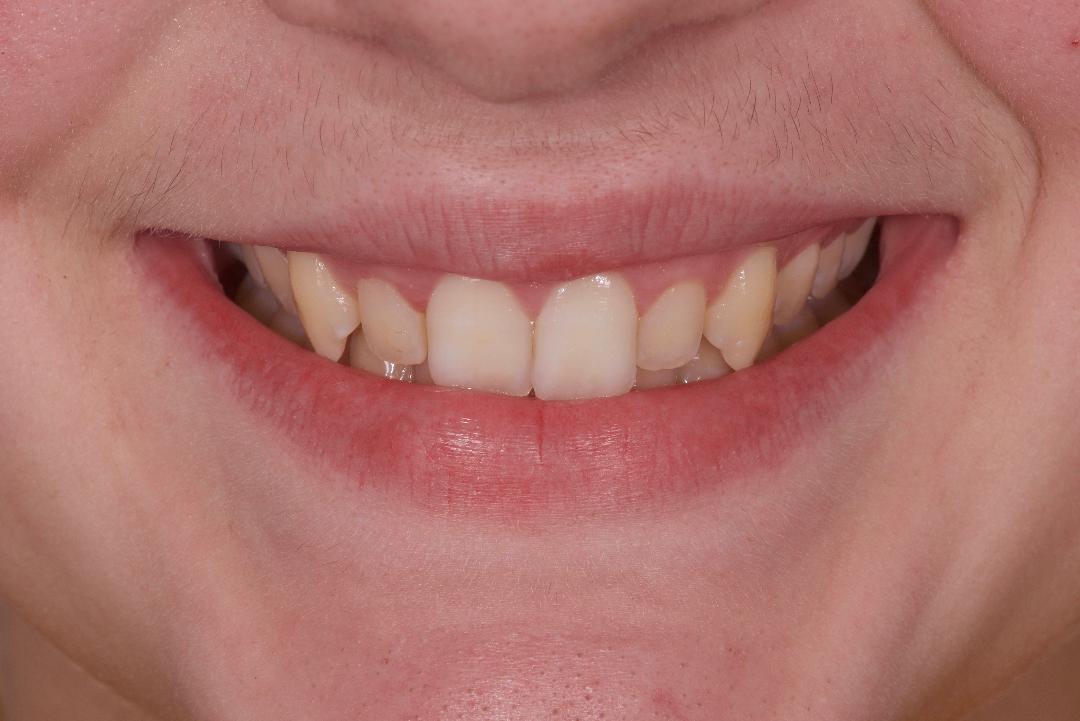 Je n'aime pas mon sourire