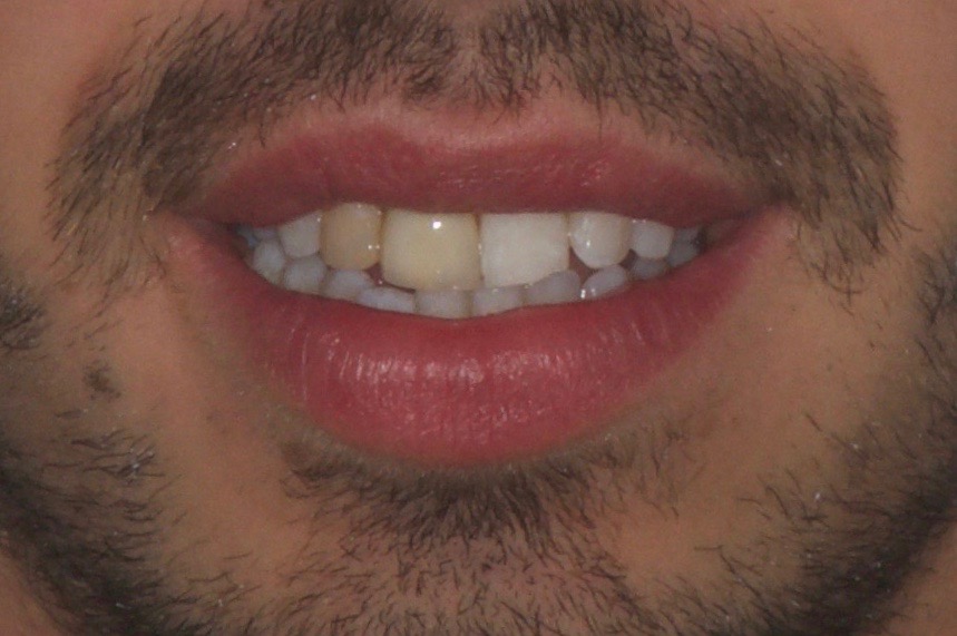 Mon sourire ne me plait pas