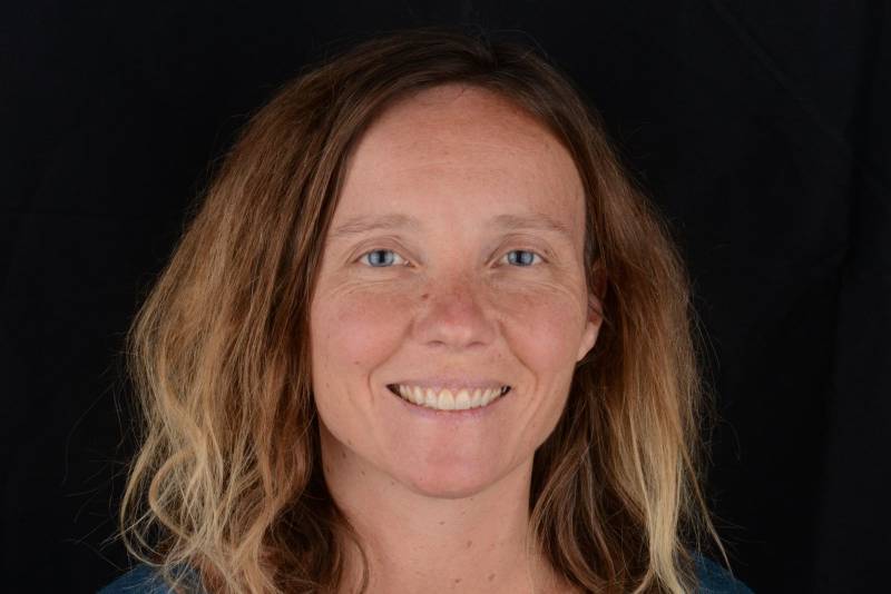 Changement du sourire grace aux facettes dentaires, au blanchiment dentaire et à l'orthodontie à Marseille Prado 13008