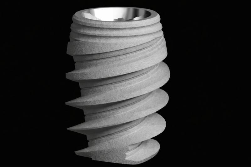 Implant dentaire en titane grade V et principes d’ostéo-intégration – Cabinet Dentaire Maupassant à Marseille