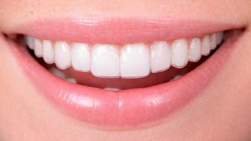 Gouttières invisible Invisalign