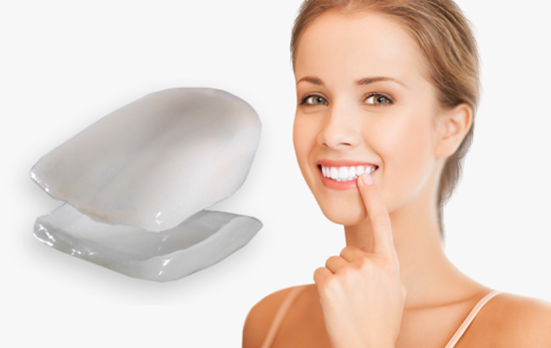 Facettes pour les dents à Marseille 13008