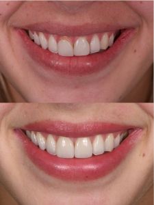 Nos prestations sur le secteur de à Marseille 13007