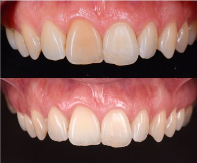 Nos prestations sur le secteur de à Marseille 13008