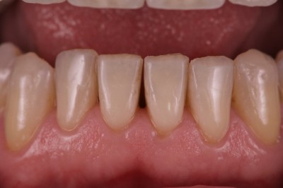 Notre zone d'activité pour ce service Dentiste pour greffe et reconstruction osseuse