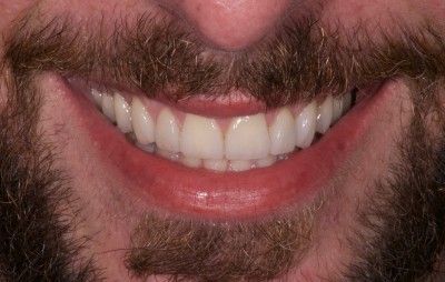 Nos prestations sur le secteur de vers Embrun en région PACA