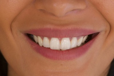 Notre zone d'activité pour ce service Dentiste pour greffe et reconstruction osseuse