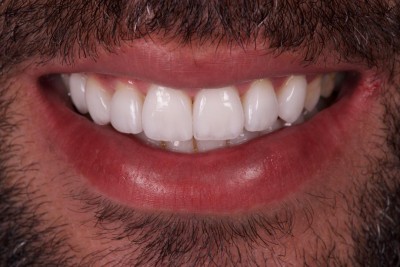 Nos prestations sur le secteur de à Marseille 13008