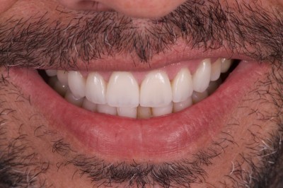 Nos prestations sur le secteur de vers Cassis et La Ciotat