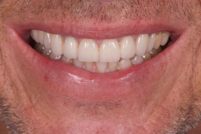 Nos prestations sur le secteur de à Prado-Périer, Marseille 8e