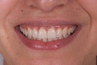 Nos prestations sur le secteur de à Prado-Périer, Marseille 8e