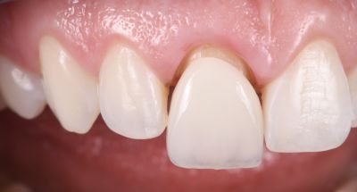 Notre zone d'activité pour ce service Cabinet d'orthodontie pour adultes et enfants