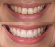 Notre zone d'activité pour ce service Dentiste pour greffe et reconstruction osseuse