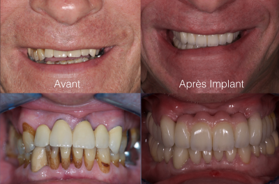 Nos prestations sur le secteur de à Marseille 13008