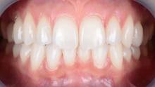Notre zone d'activité pour ce service Cabinet d'orthodontie pour adultes et enfants