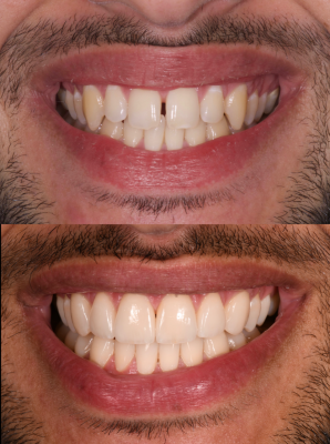 Nos prestations sur le secteur de au Roucas Blanc,  Marseille 7e